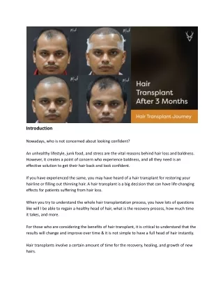 Hair Transplant Journey_ Hair Transplant After 3 Months - Results