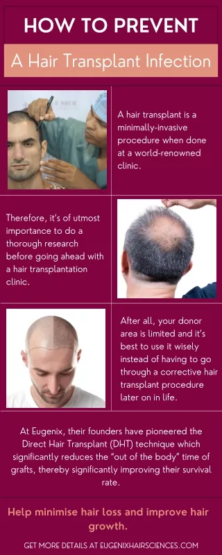 How To Prevent A Hair Transplant Infection