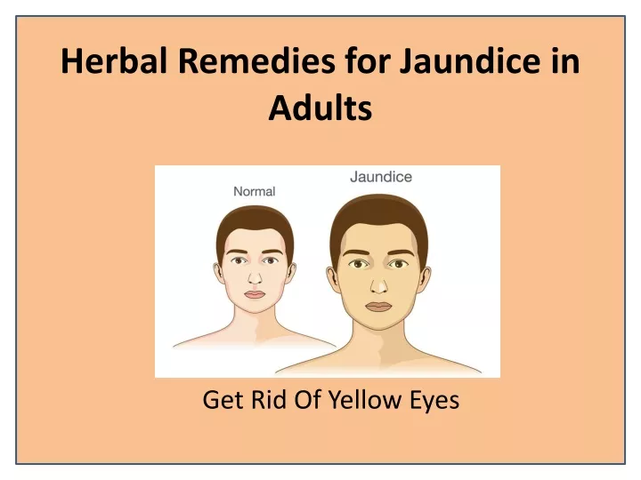 herbal remedies for jaundice in adults
