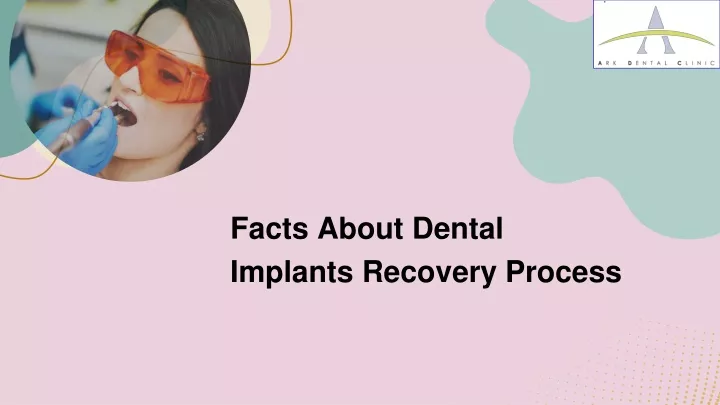 PPT - Facts About Dental Implants Recovery Process PowerPoint ...