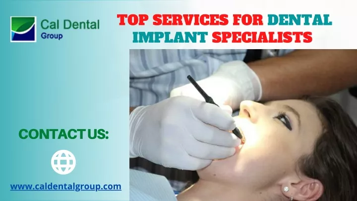 top services for dental implant specialists