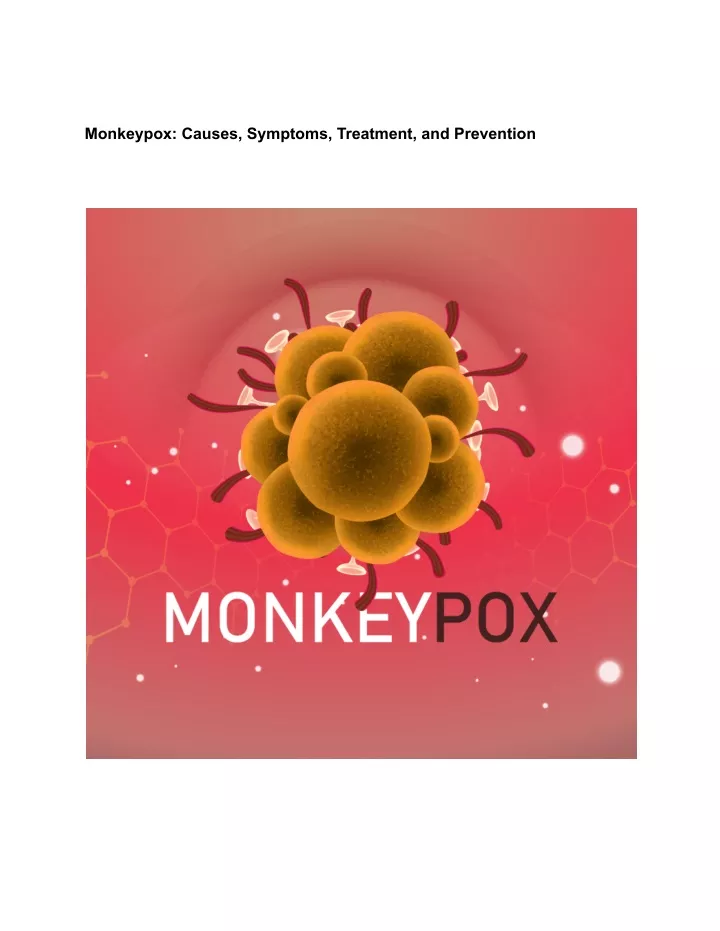 monkeypox causes symptoms treatment and prevention