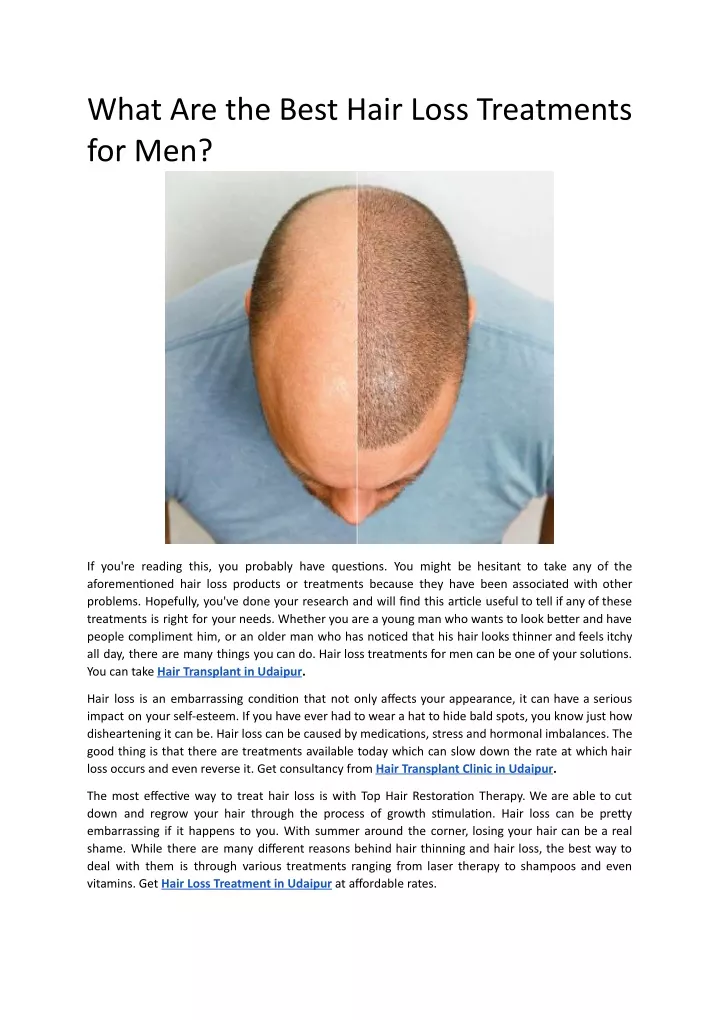 Ppt What Are The Best Hair Loss Treatments For Men Powerpoint Presentation Id11568328 2953