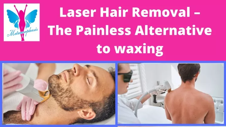 laser hair removal the painless alternative