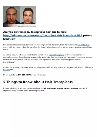 Natural Hair Transplants and  Is Hair Transplant Safe in 2022