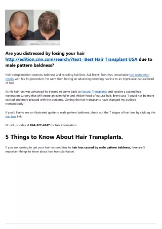 Natural Transplants, Hair Restoration and  Alopecia Treatment in 2022