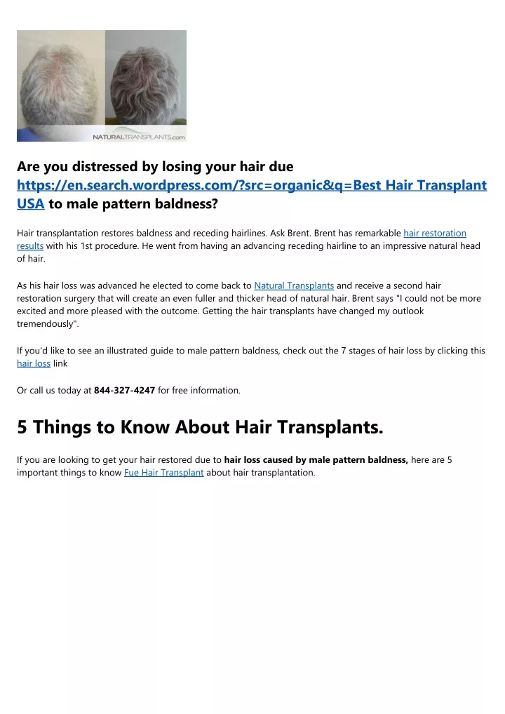 are you distressed by losing your hair due https
