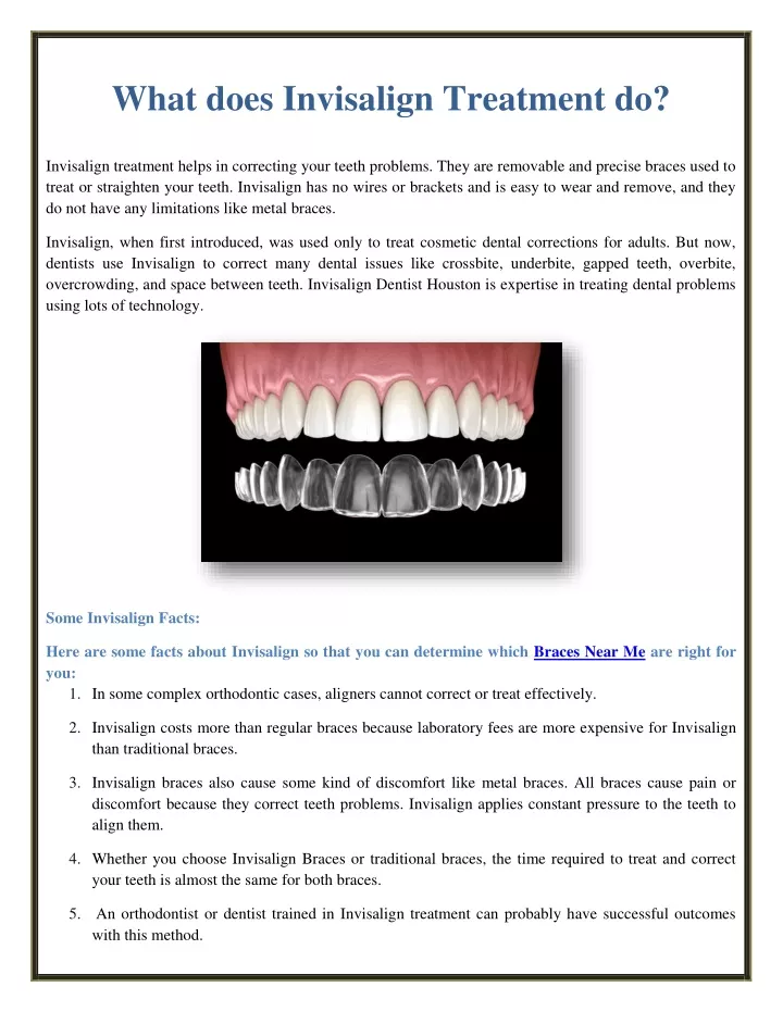 what does invisalign treatment do