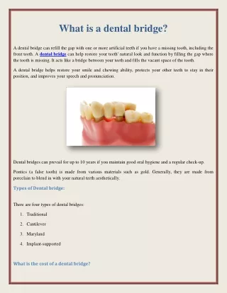 what is a dental bridge
