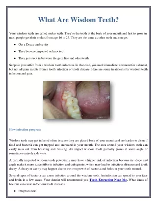what are wisdom teeth