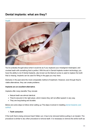Dental implants what are they