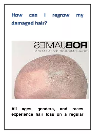 all ages genders and races experience hair loss