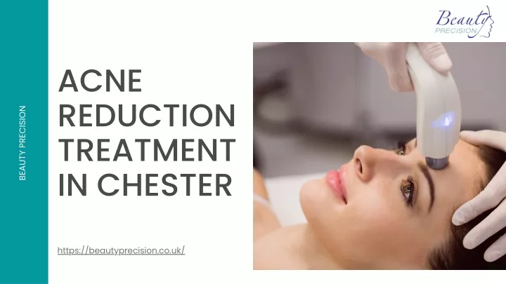 acne reduction treatment in chester