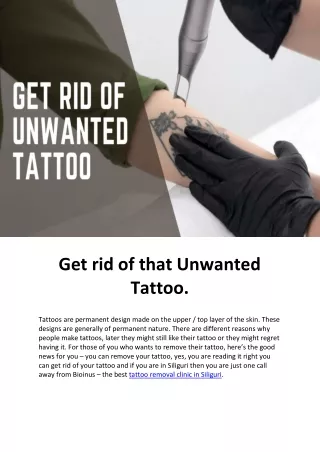 Get rid of that Unwanted Tattoo (22-8-22)