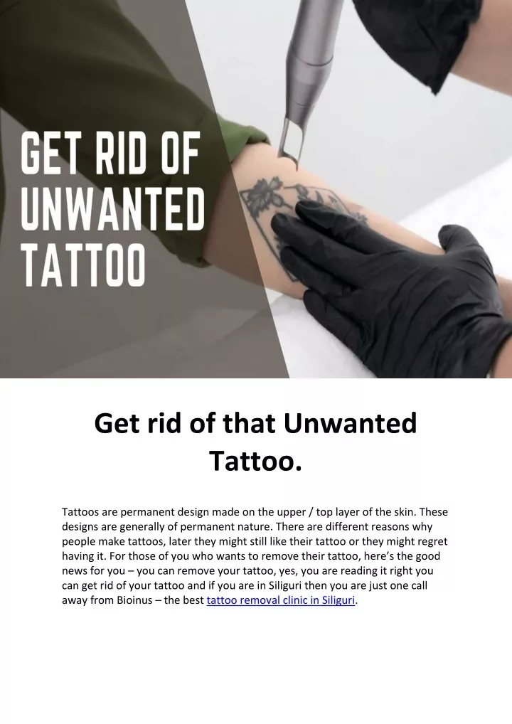 get rid of that unwanted tattoo tattoos