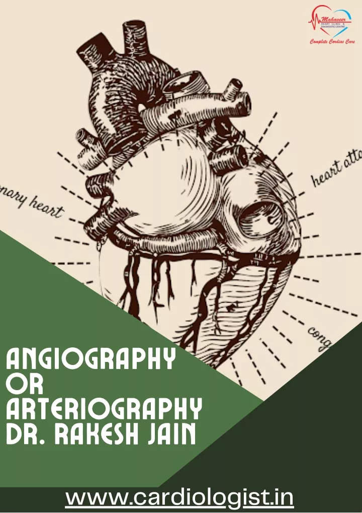angiography or arteriography dr rakesh jain