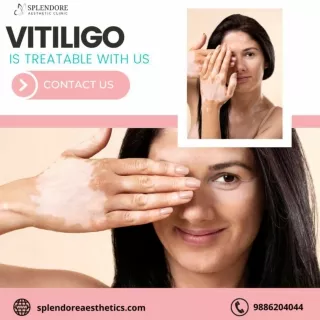 Non-surgical Cosmetic Gynaecology in HSR Layout | Splendore Aesthetic