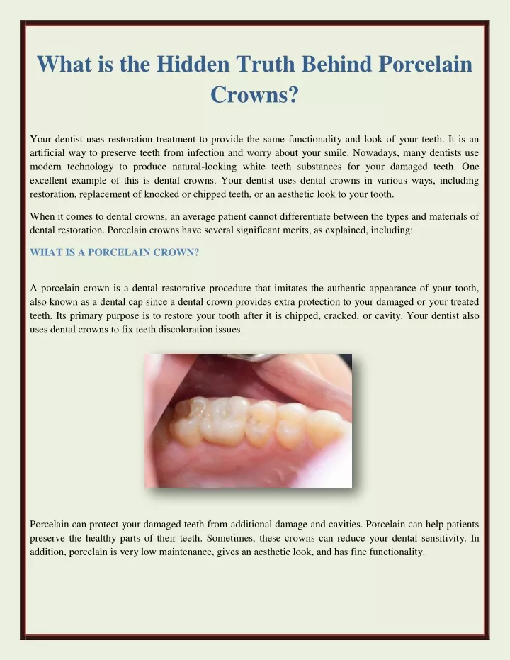what is the hidden truth behind porcelain crowns