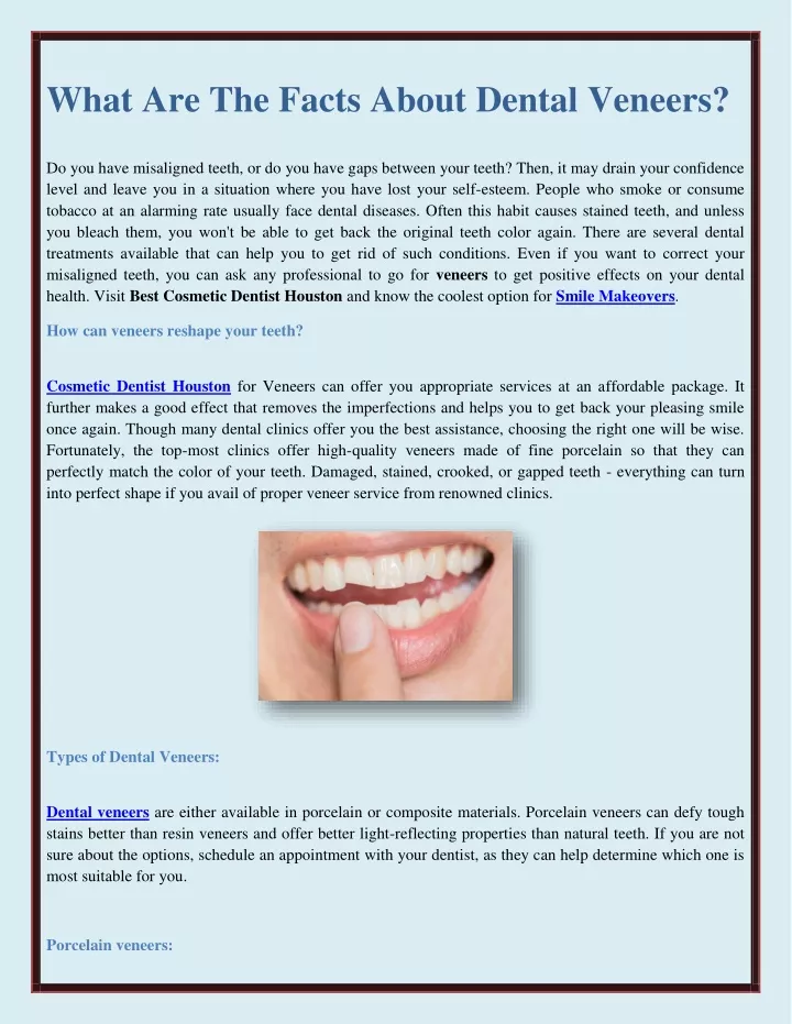 what are the facts about dental veneers