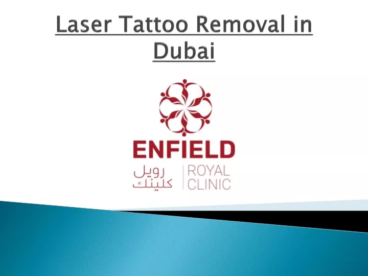 laser tattoo removal in dubai