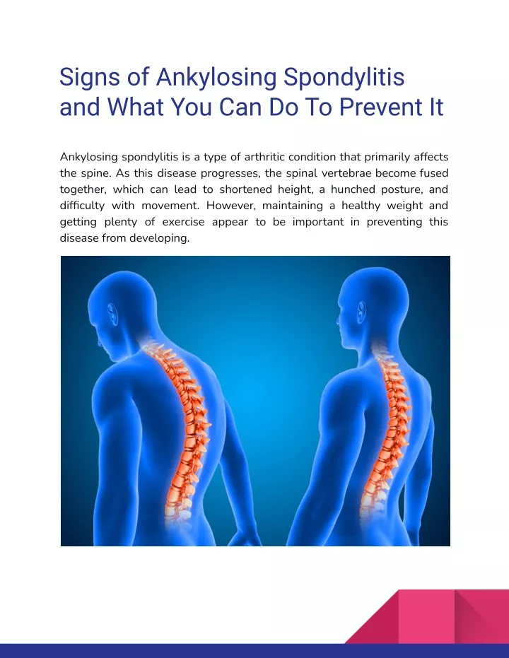 signs of ankylosing spondylitis and what