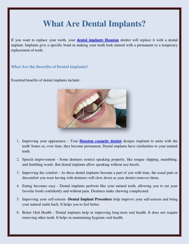 PPT - What Are Dental Implants? PowerPoint Presentation, Free Download ...