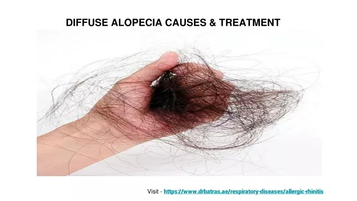 diffuse alopecia causes treatment