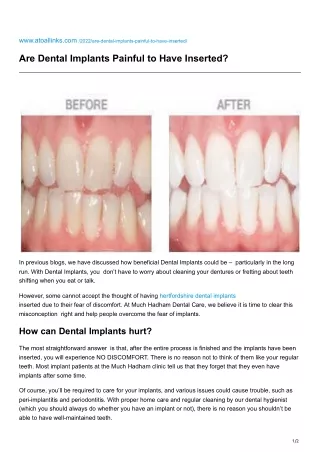 www atoallinks com 2022 are dental implants