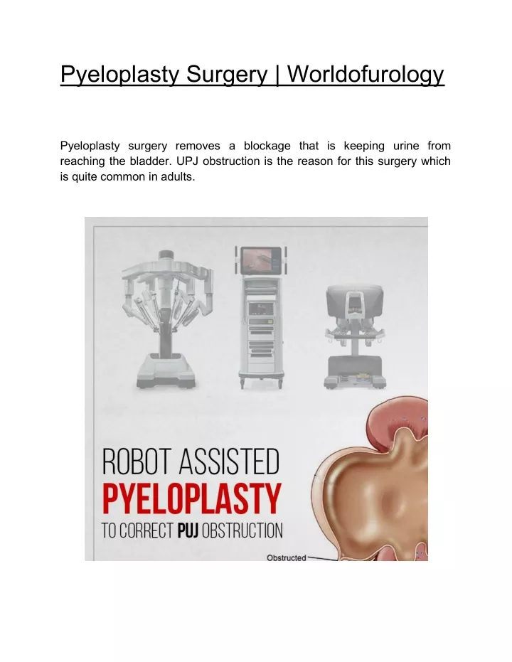 pyeloplasty surgery worldofurology