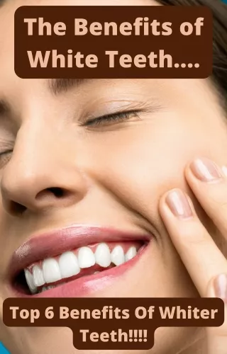 Whiter Teeth EBOOK