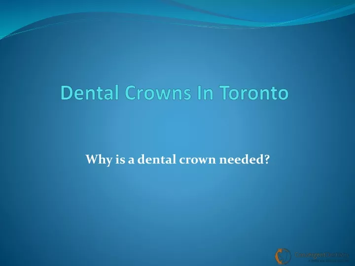 dental crowns in toronto