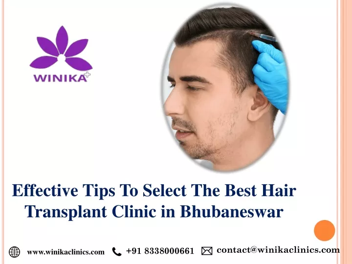 effective tips to select the best hair transplant