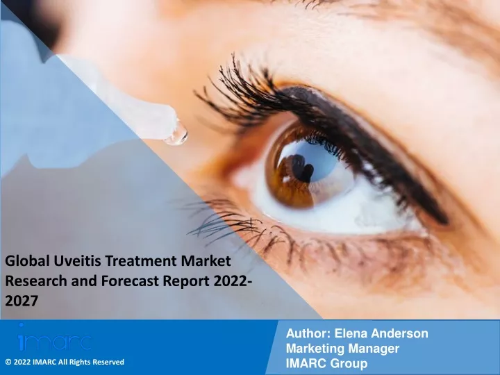 global uveitis treatment market research