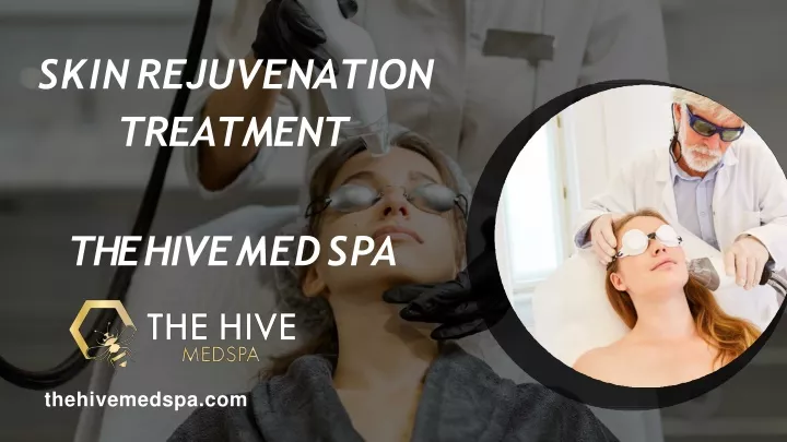 skin rejuvenation treatment