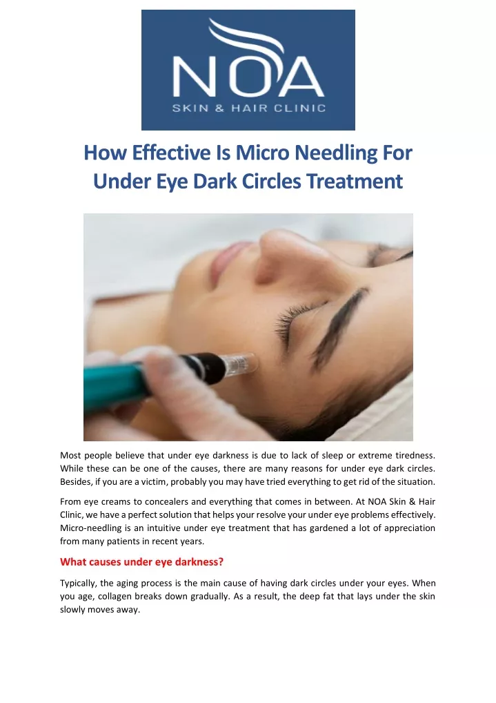 how effective is micro needling for under