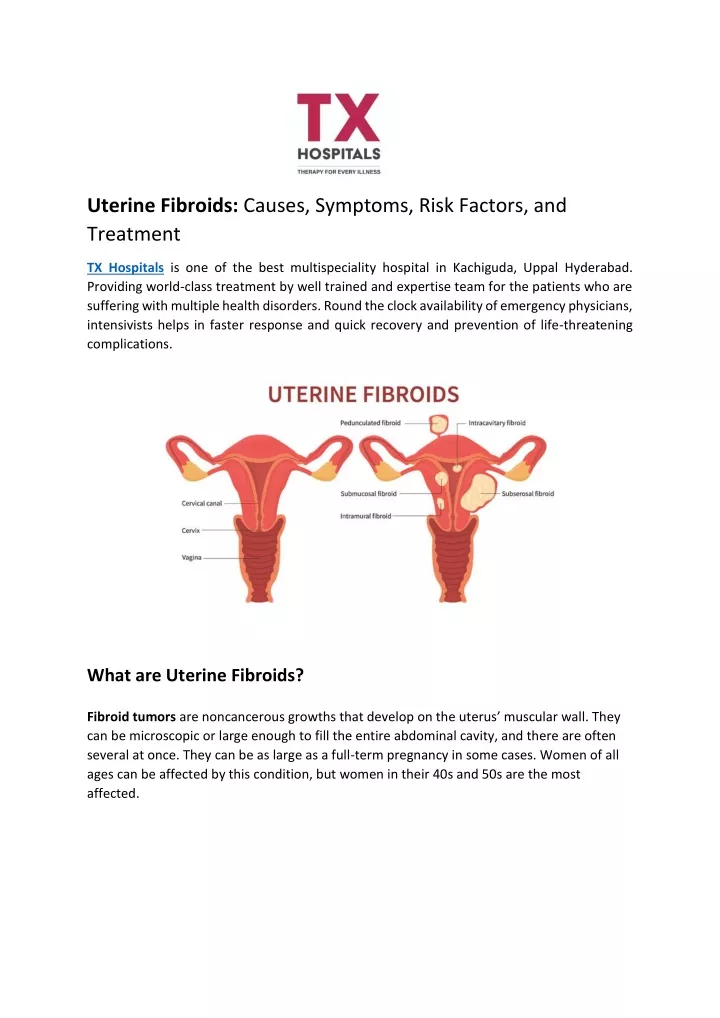 Ppt Uterine Fibroids Causes Symptoms Risk Factors And Treatment Powerpoint Presentation 