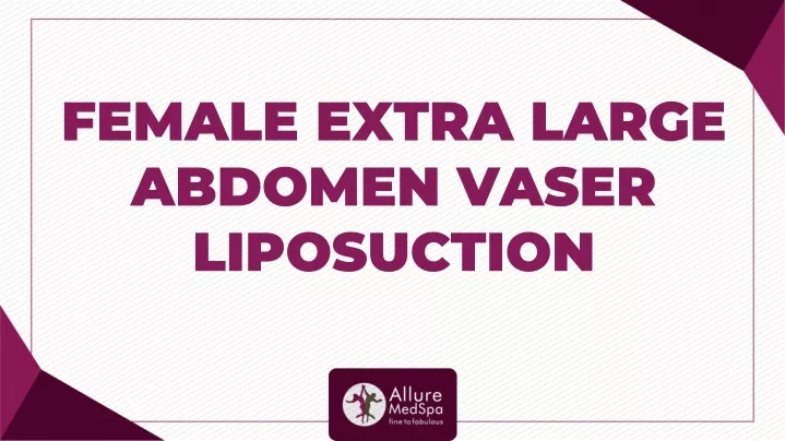 female extra large abdomen vaser liposuction