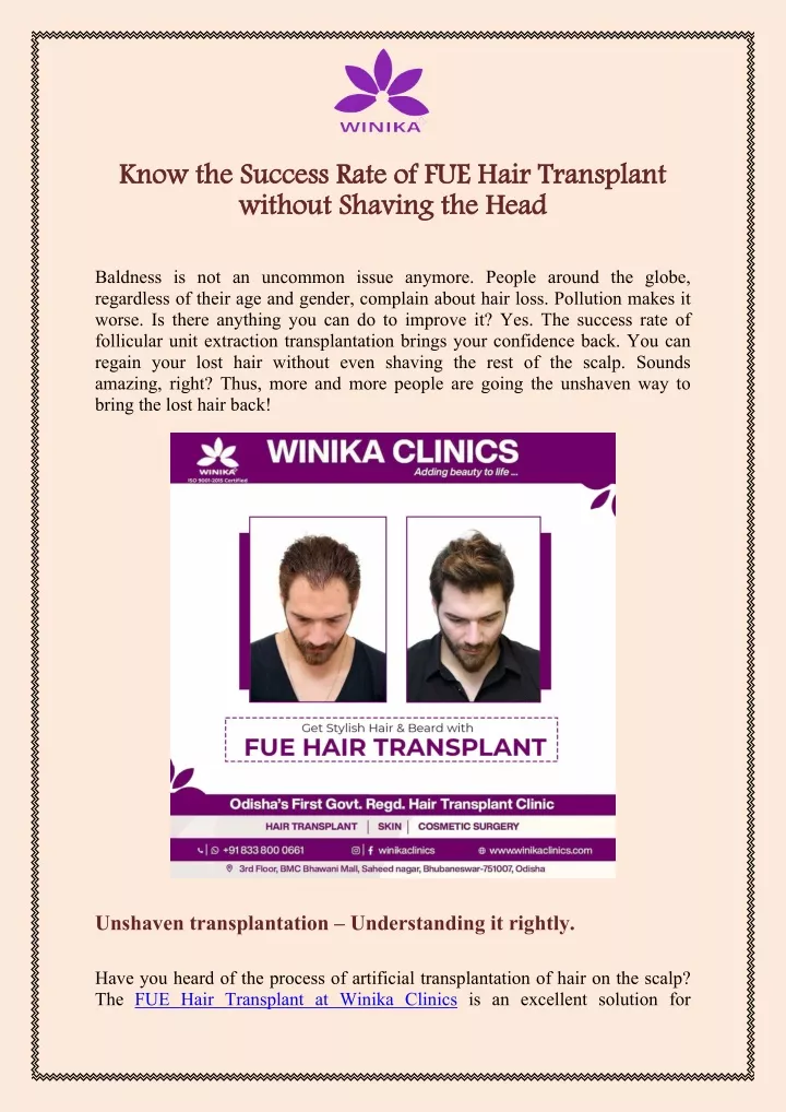 know the success rate of fue hair transplant