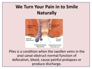 we turn your pain in to smile naturally
