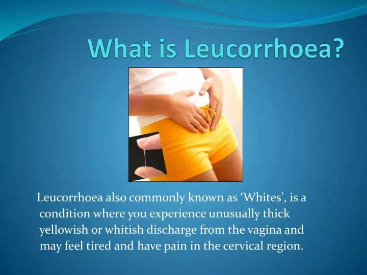 what is leucorrhoea