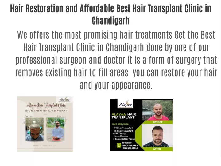 hair restoration and affordable best hair