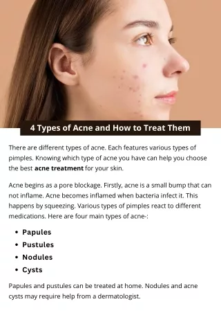 4 types of acne and how to treat them