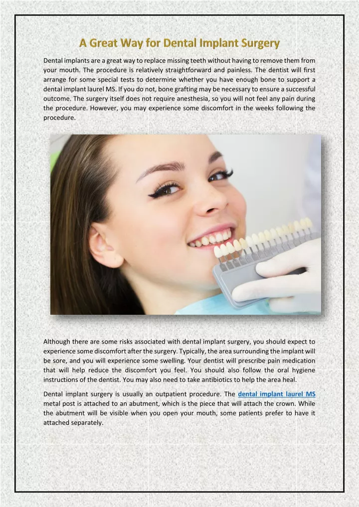 dental implants are a great way to replace