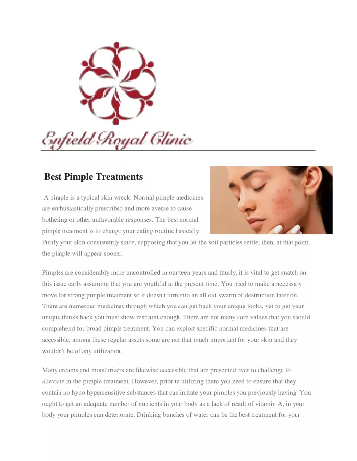 best pimple treatments