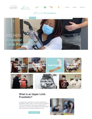Upper Limb Prosthetics | Prosthetic Provider NYC | Eschen P&O Labs