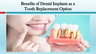 Benefits of Dental Implants as a Tooth Replacement Option
