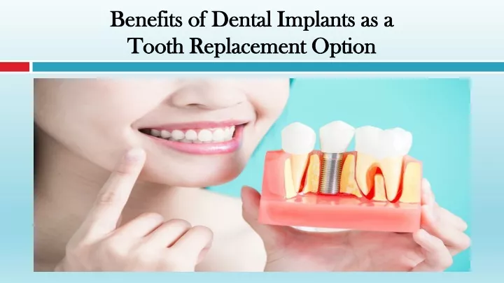 benefits of dental implants as a tooth replacement option