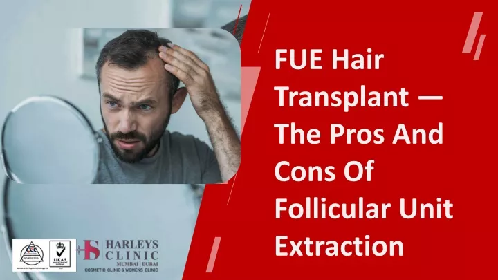 fue hair transplant the pros and cons