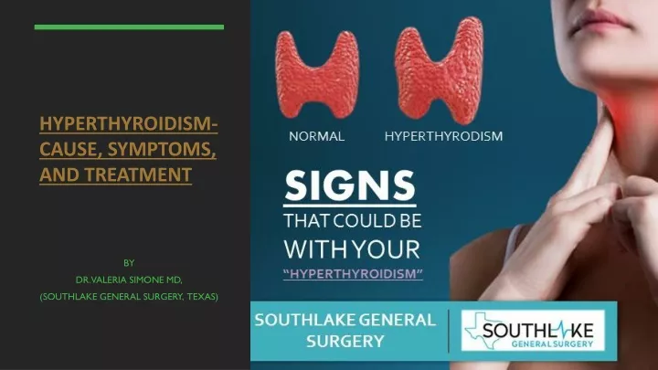 hyperthyroidism cause symptoms and treatment