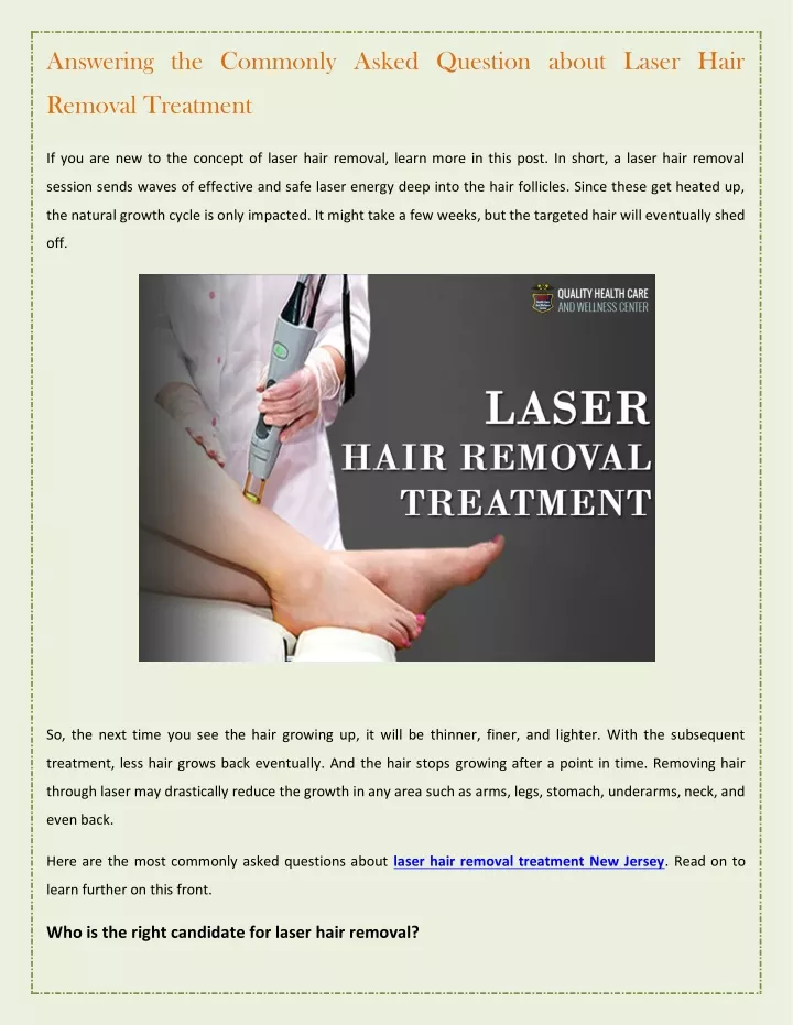 answering the commonly asked question about laser
